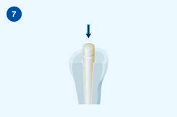 Применение Люксакор Z Дуал Смартмикс - этап 7